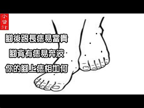 腳側邊有痣|非富即貴！5種腳相註定好命 痣長在這裡「天生帝王命。